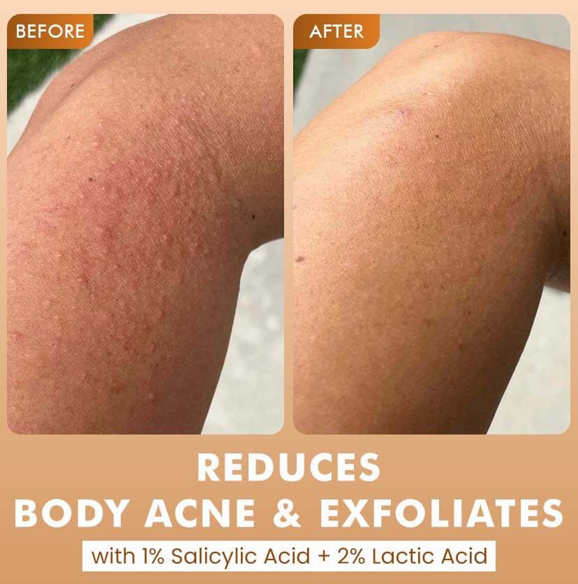 Exfoliating Caramel Crunch Body Wash - 300 ml