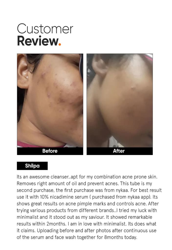 Salicylic Acid + LHA 2% Cleanser — photo 5