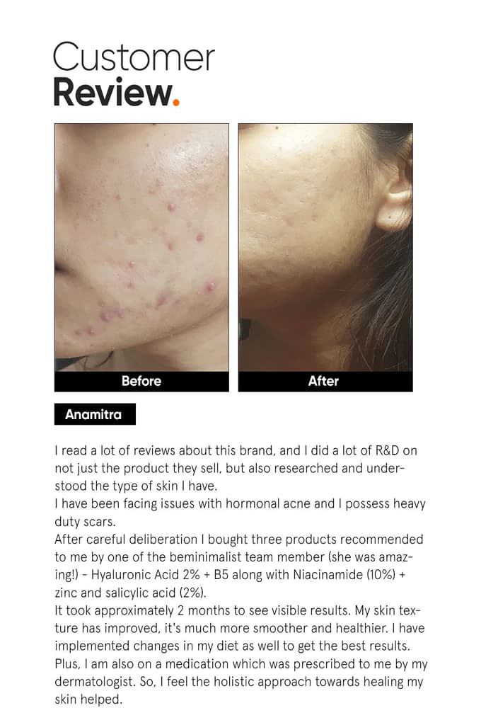 Hyaluronic + PGA 2% Face Serum — photo 5