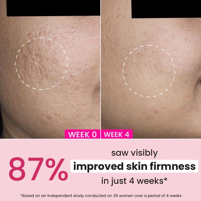 Pomegranate + Multi-Peptide Anti Ageing Moisturizer SPF 30 — photo 3