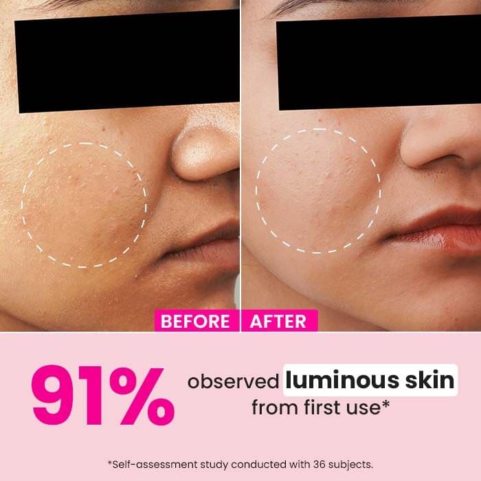 Watermelon & 10% Glycolic Serum — photo 3