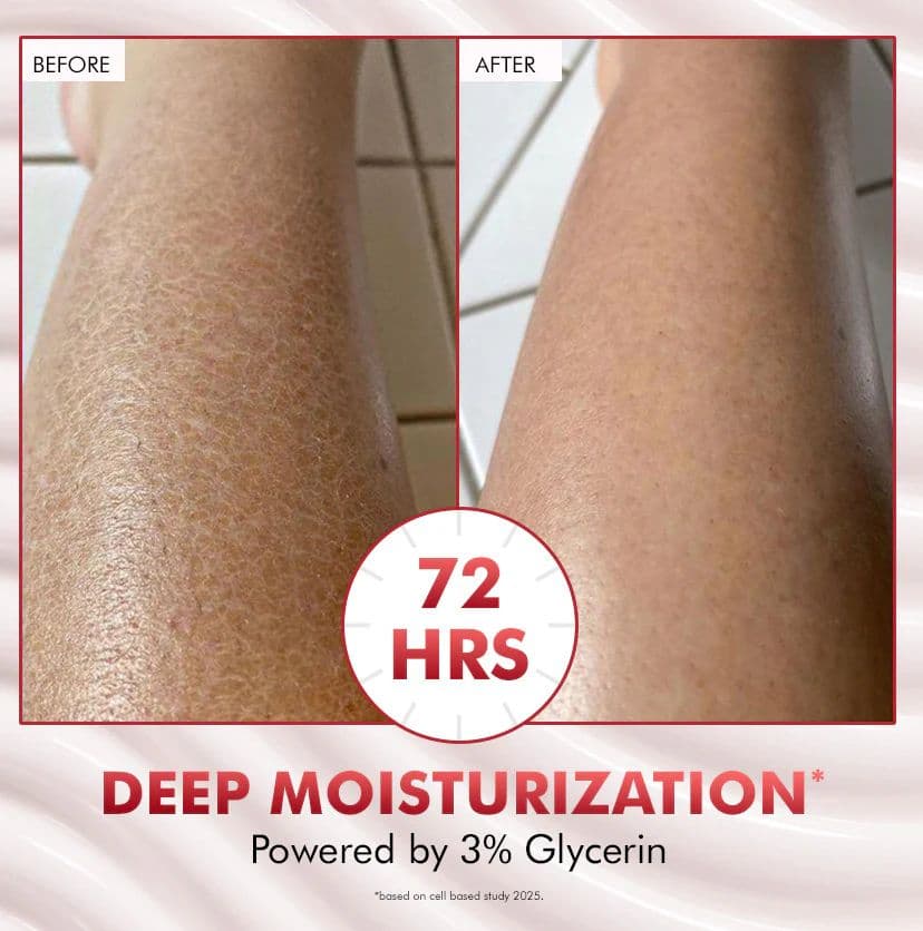 11% AHA BHA Strawberry Body Lotion for Skin Smoothening