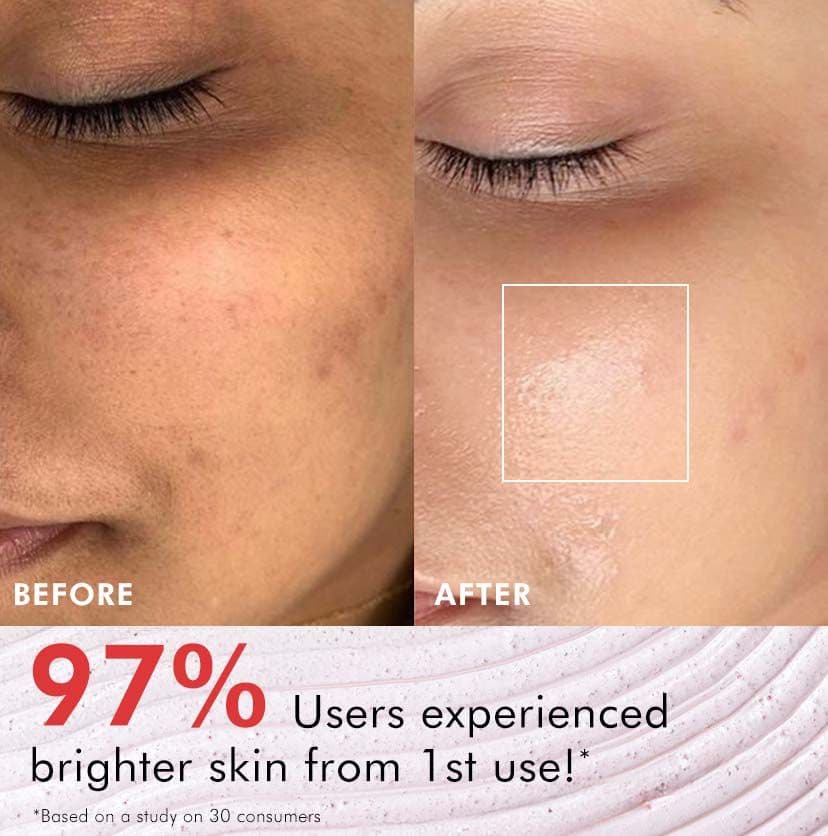 Berries Brightening Coffee Face Scrub - 75 gm