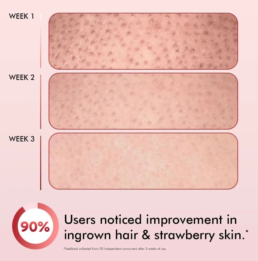 11% AHA BHA Strawberry Body Lotion for Skin Smoothening