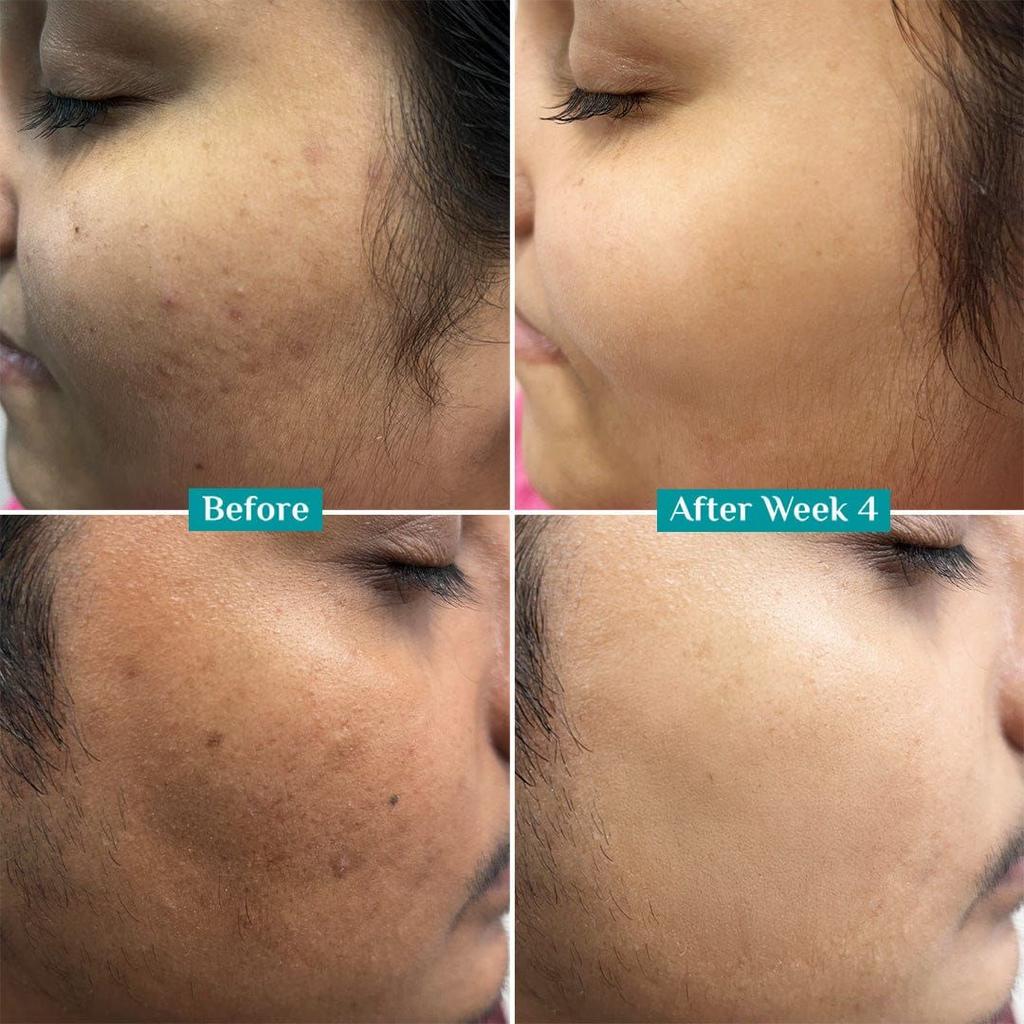 10% Vitamin C Face Serum For Daily Brightness