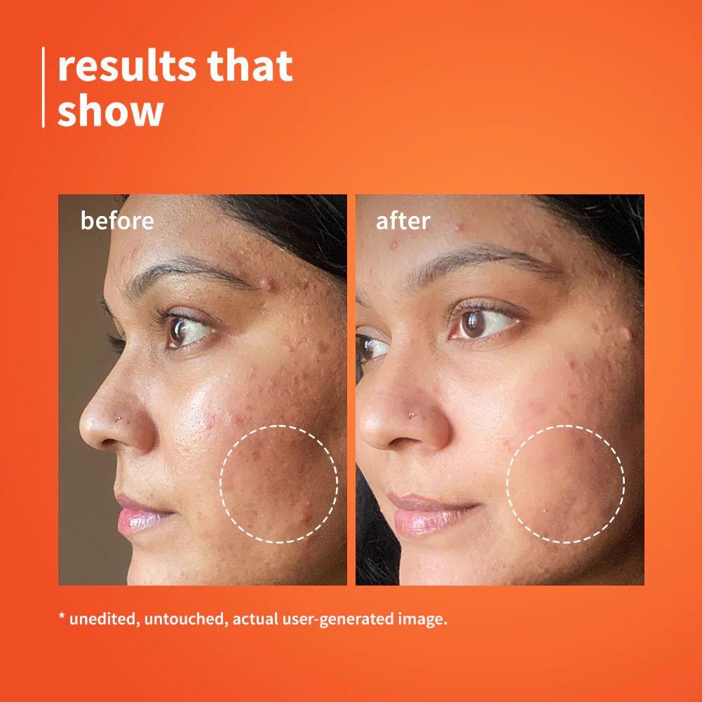 10% Vitamin C & Calendula Barrier Boosting + Glow Serum