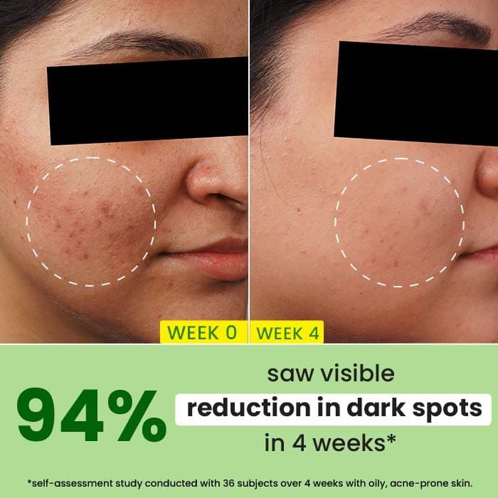Cica + 10% Niacinamide Face Serum for Oily Skin — photo 3