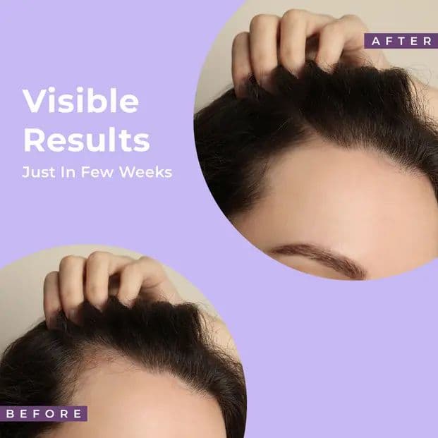 Rosemary & Biotin Hair Growth Water Spray Denser, Thicker Hair