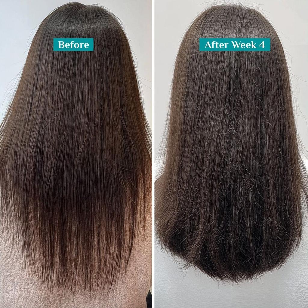 Redensyl & Anagain Hairfall Control Shampoo — photo 8