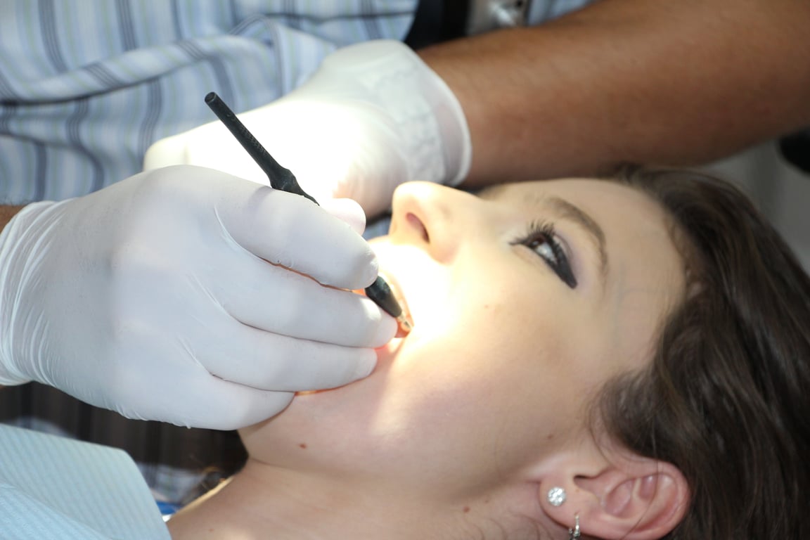 dog dental cleaning veterinarian