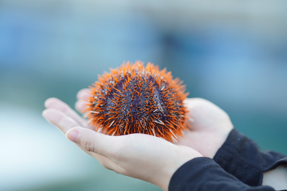 sea urchin chawanmushi