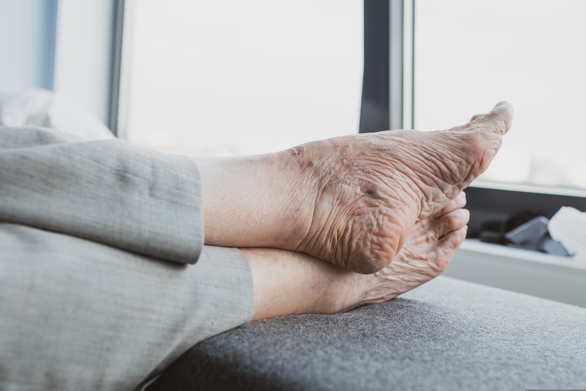 senior living community