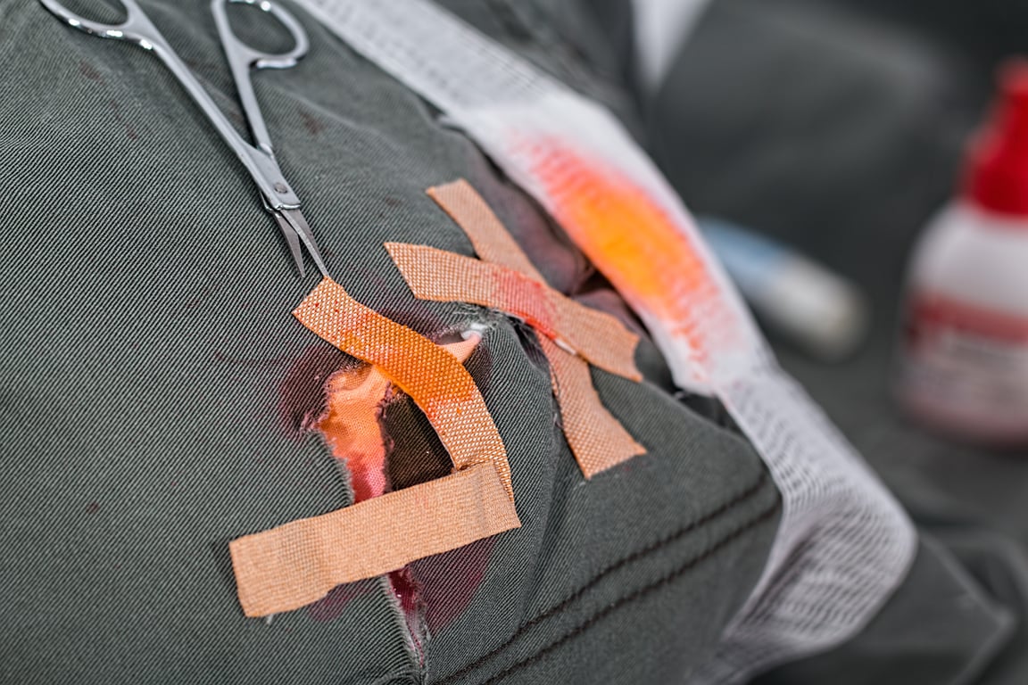 wilderness first aid training