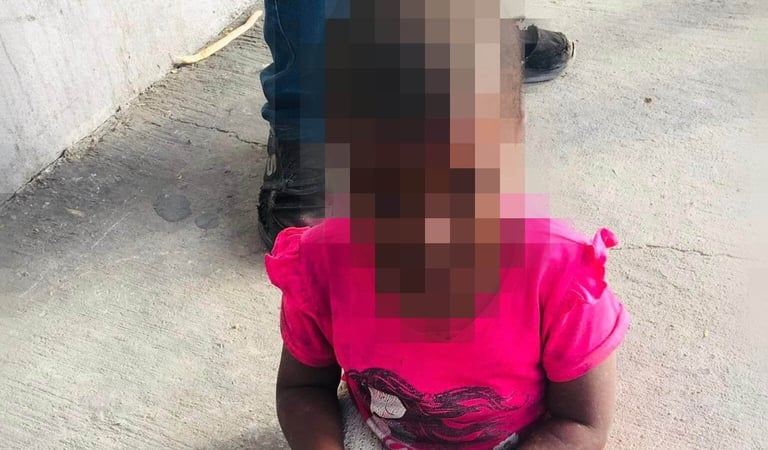Criança angolana com malformação congénita carece de ajuda médica urgente