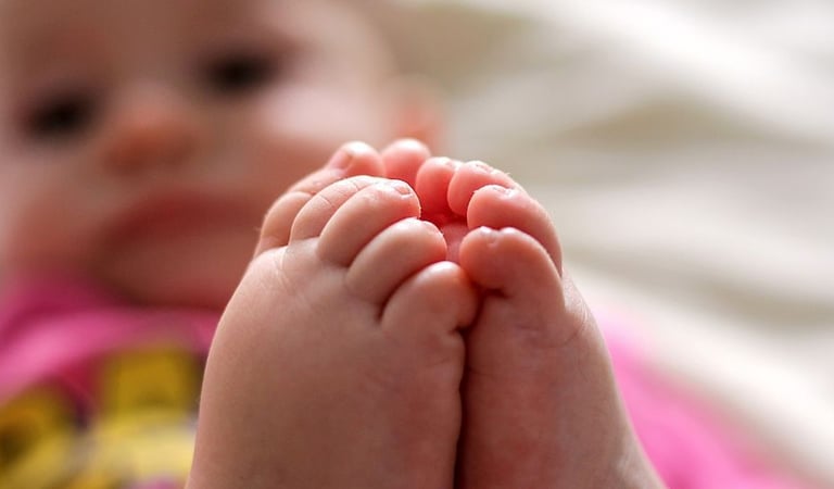 Bebé nasce com 26 dedos e um pé no joelho