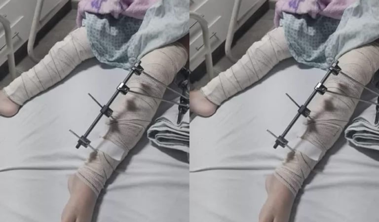 Médicos afastados após operarem perna errada de criança de 6 anos