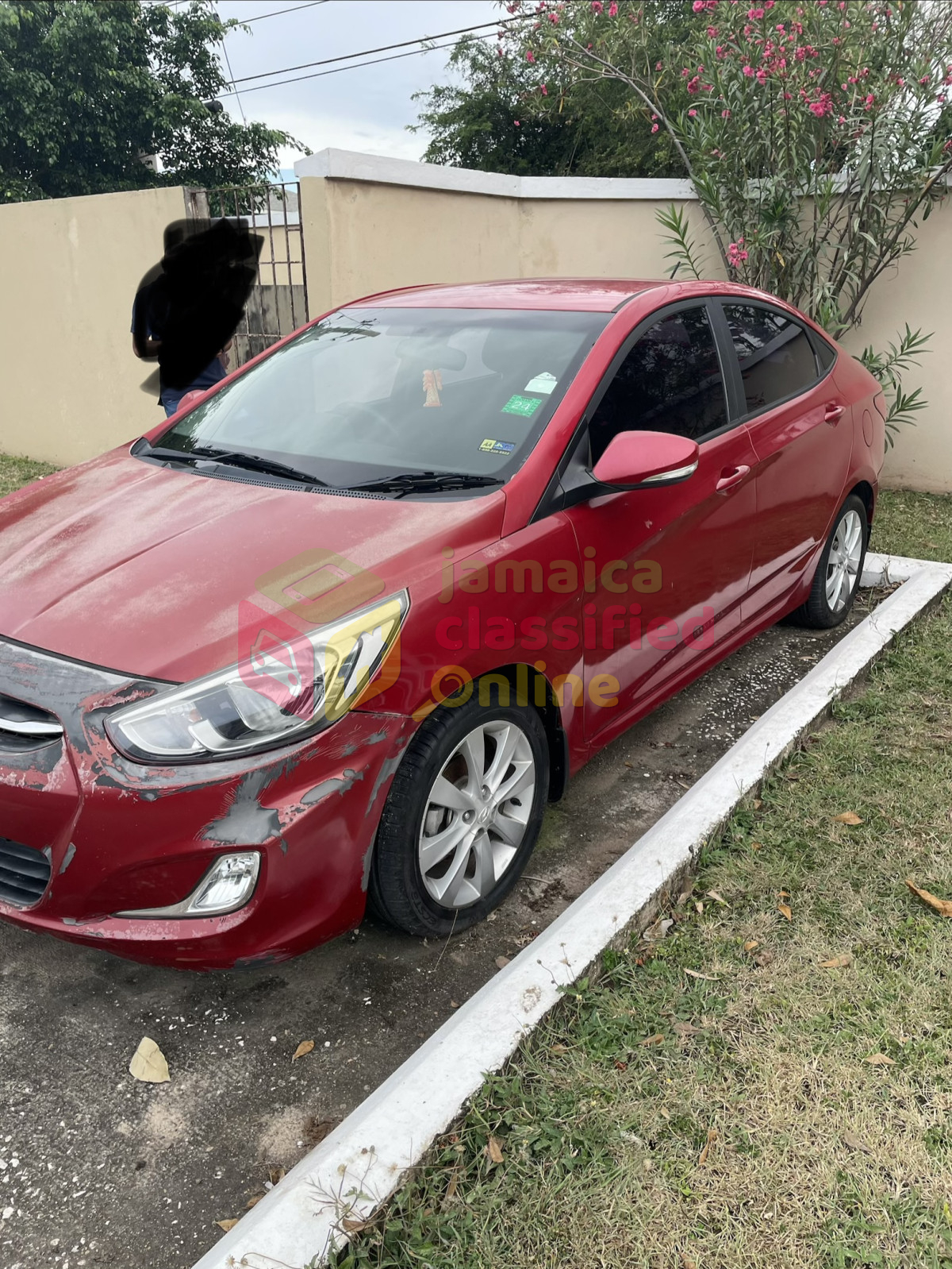 2017 HYUNDAI Accent