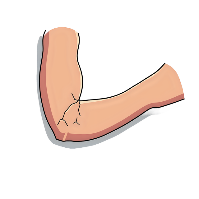 Free transparent PNG: Bent Arm with Cracked Surface  Unique Design Clipart, free downloadable png