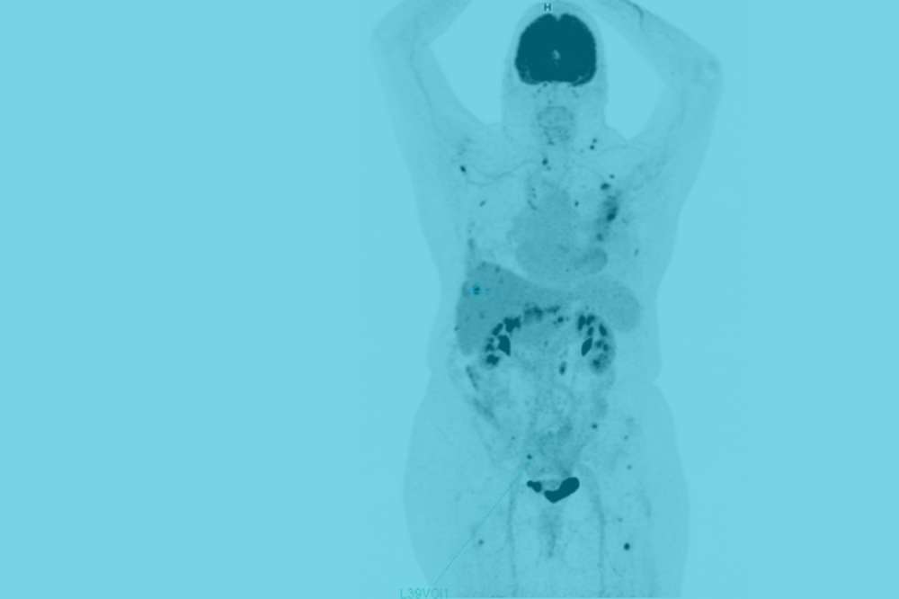 Euranova et l’Institut Carnot CALYM s’associent pour améliorer la découverte de biomarqueurs grâce à l'IA