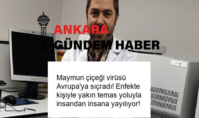 Maymun çiçeği virüsü Avrupa’ya sıçradı! Enfekte kişiyle yakın temas yoluyla insandan insana yayılıyor!