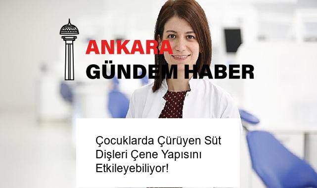 Çocuklarda Çürüyen Süt Dişleri Çene Yapısını Etkileyebiliyor!