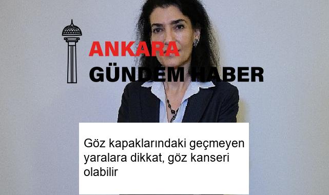 Göz kapaklarındaki geçmeyen yaralara dikkat, göz kanseri olabilir