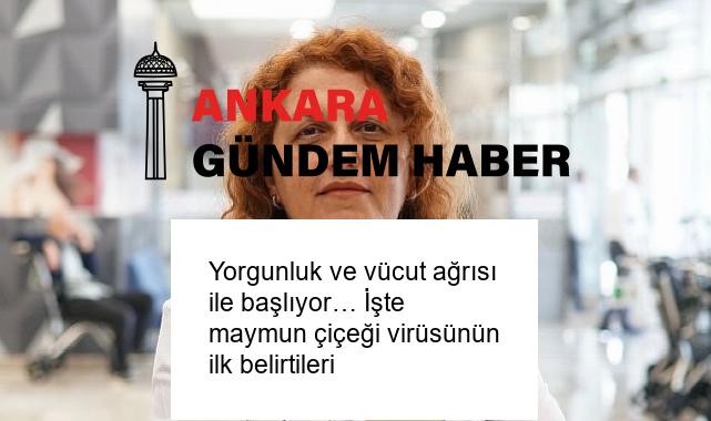 Yorgunluk ve vücut ağrısı ile başlıyor… İşte maymun çiçeği virüsünün ilk belirtileri