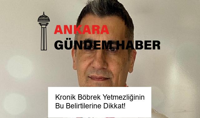 Kronik Böbrek Yetmezliğinin Bu Belirtilerine Dikkat!