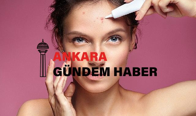 Akne tedavisinde yapılan 10 önemli hata !