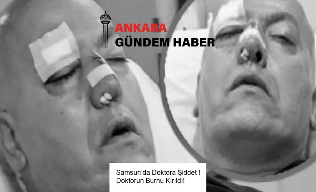 Samsun’da Doktora Şiddet ! Doktorun Burnu Kırıldı!