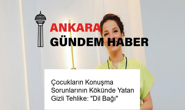 Çocukların Konuşma Sorunlarının Kökünde Yatan Gizli Tehlike: “Dil Bağı”