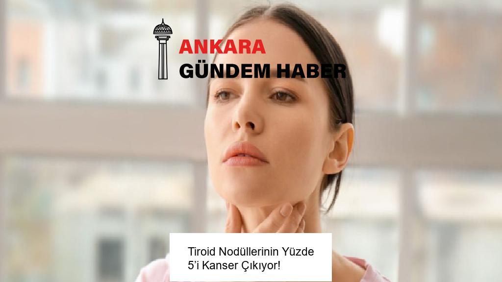 Tiroid Nodüllerinin Yüzde 5’i Kanser Çıkıyor!