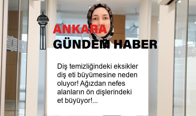 Diş temizliğindeki eksikler diş eti büyümesine neden oluyor! Ağızdan nefes alanların ön dişlerindeki et büyüyor!