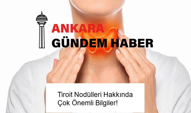 Tiroit Nodülleri Hakkında Çok Önemli Bilgiler!
