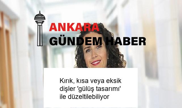 Kırık, kısa veya eksik dişler ‘gülüş tasarımı’ ile düzeltilebiliyor