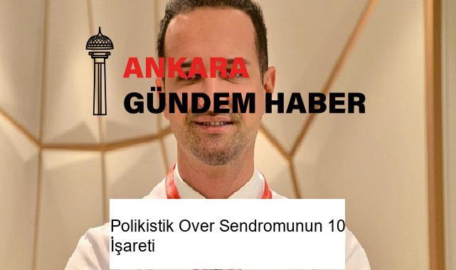 Polikistik Over Sendromunun 10 İşareti
