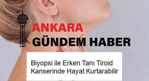 Biyopsi ile Erken Tanı Tiroid Kanserinde Hayat Kurtarabilir