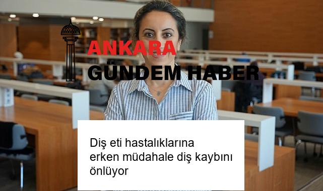 Diş eti hastalıklarına erken müdahale diş kaybını önlüyor