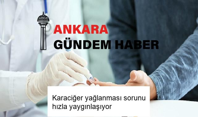 Karaciğer yağlanması sorunu hızla yaygınlaşıyor