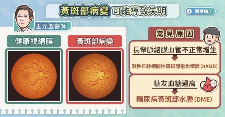 女眼中「電線桿變形」 竟是黃斑部病變惹禍！教你1招看圖自我檢測