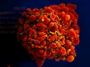 未來愛滋病有望痊癒？美國公布首位女性愛滋病毒治癒者案例