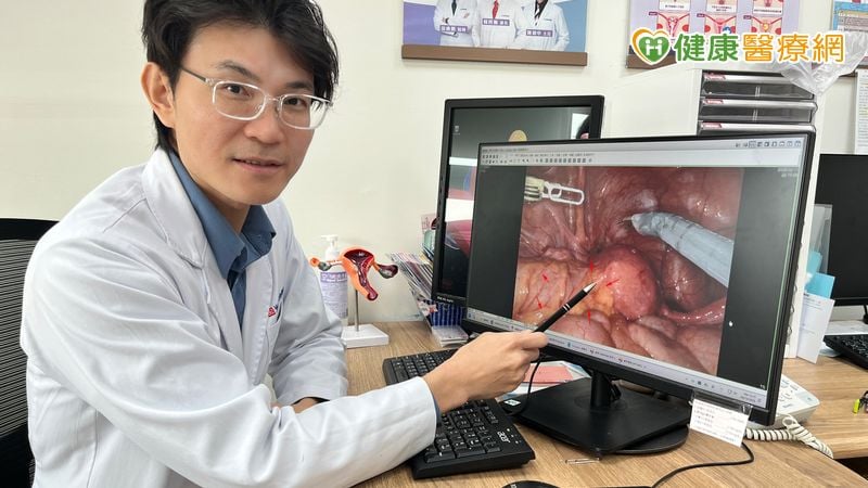 巧克力囊腫復發導致腎水腫　醫療團隊聯手成功保腎 | yam News