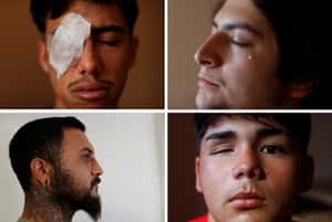 至少270人眼睛被擊中  國際特赦組織報告：智利政府刻意「懲罰」示威者