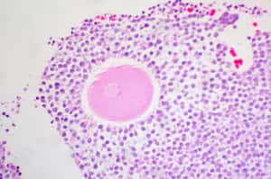 英批准首例基因改造胚胎，研究造成不孕症原因