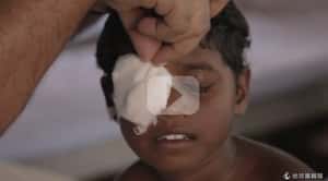 感動時刻  影片紀錄盲眼姊妹重見光明的瞬間