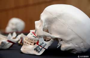 在數千年前的人骨上  找到B型肝炎的病毒