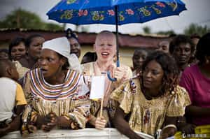 他們被當作「藥材」活在恐懼裡的馬拉威白化症患者