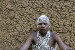 肯亞8男被迫割包皮