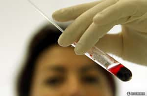 前伊波拉患者血液抗體  成功保護猴子存活