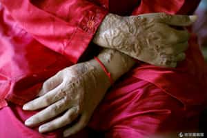 全天候保護還是出事  印度女子第五度被硫酸攻擊